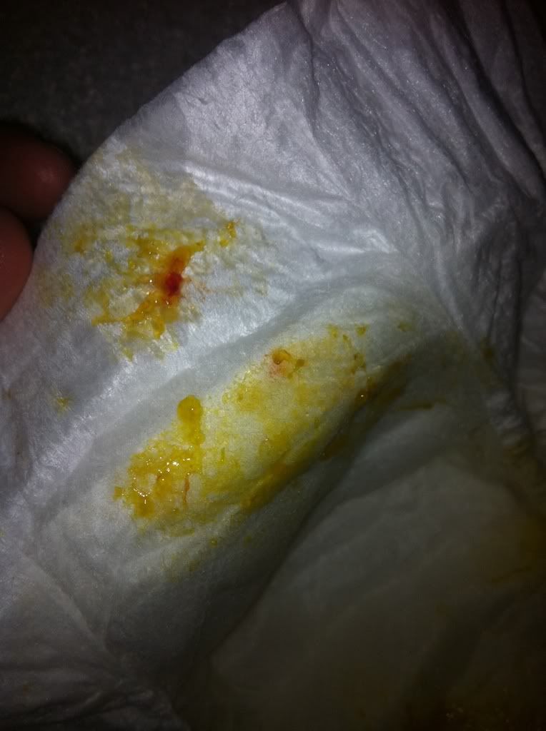 Blood in LOs diaper BabyCenter
